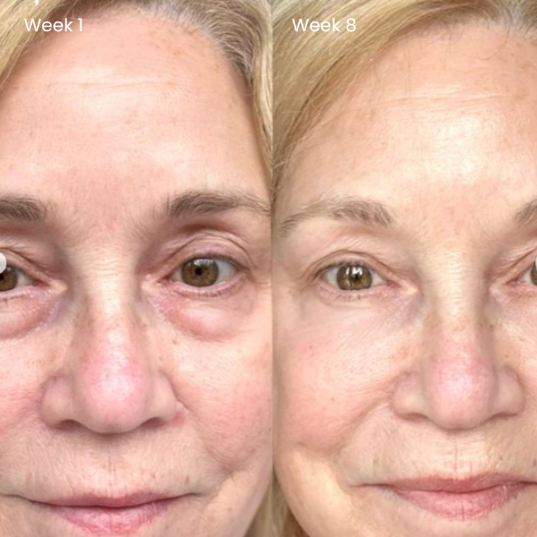 Dermora™ Time Reset Cream (All-In-One)