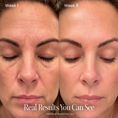 Dermora™ Time Reset Cream (All-In-One)