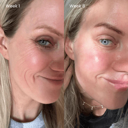 Dermora™ Time Reset Cream (All-In-One)